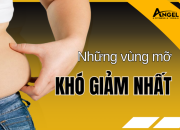 Những vùng mỡ khó giảm nhất 