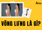 Võng Lưng Là Gì? 5 Bài Tập Đơn Giản Cải Thiện Vóc Dáng Hiệu Quả