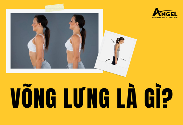 Võng Lưng Là Gì? 5 Bài Tập Đơn Giản Cải Thiện Vóc Dáng Hiệu Quả